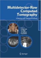 Multidetector-Row Computed Tomography: Scanning and Contrast Protocols артикул 382e.